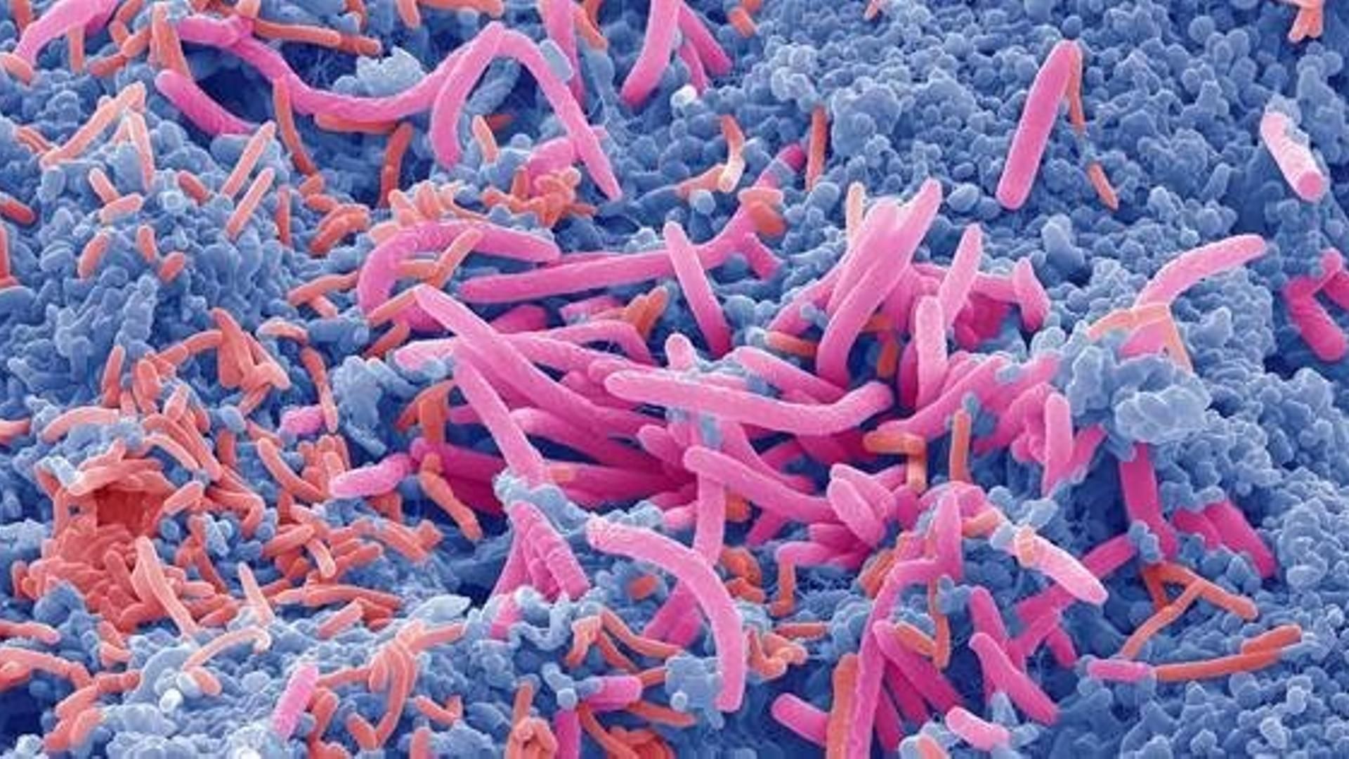 Detalle de la microbiota intestinal vista al microscopio