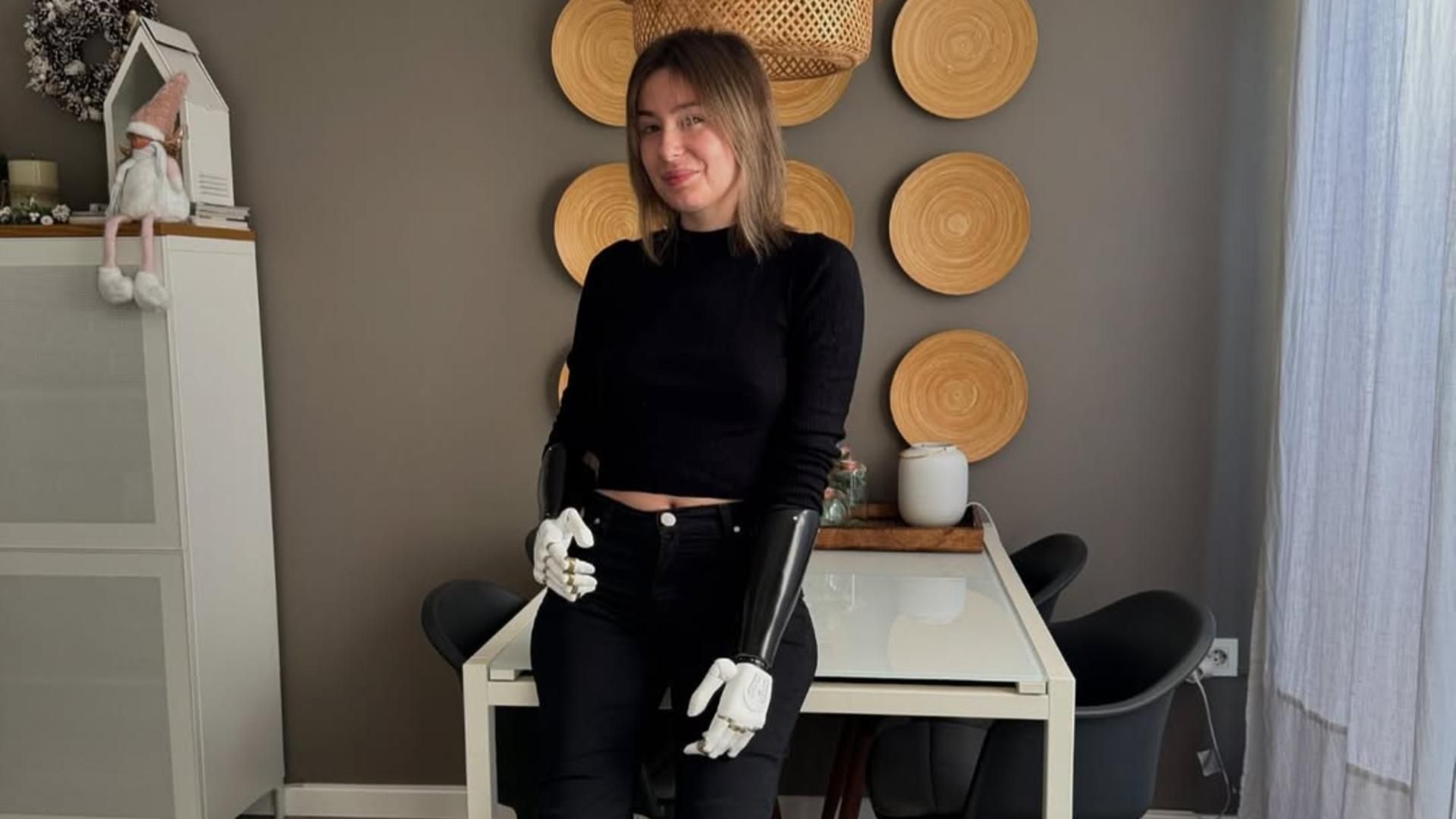 Carla Maronda usa brazos y pies biónicos tras la amputación