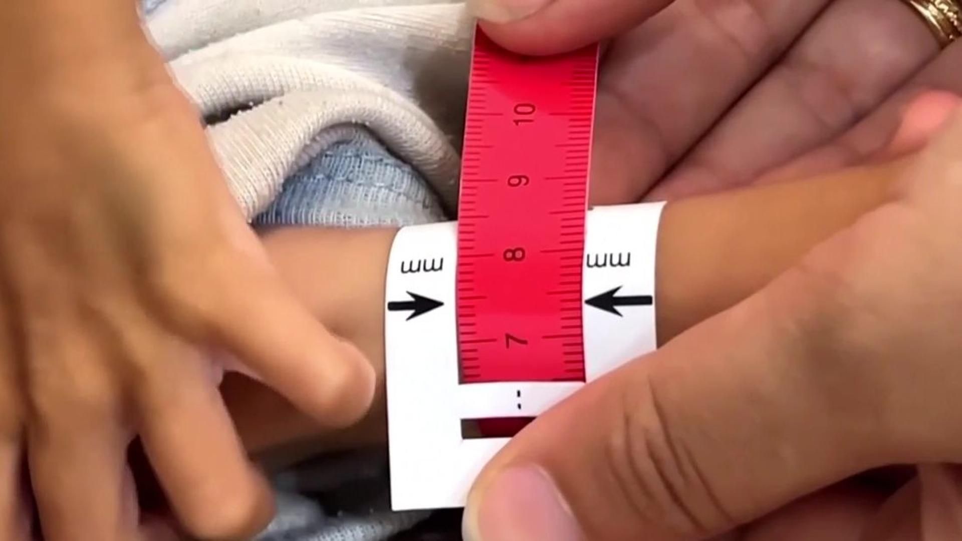 La hambruna ya es oficial en gran parte de la Franja de Gaza, según la ONU