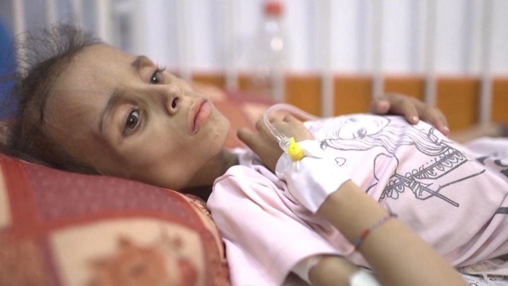 La ONU declara oficialmente la hambruna en la ciudad de Gaza: está en "condiciones catastróficas"