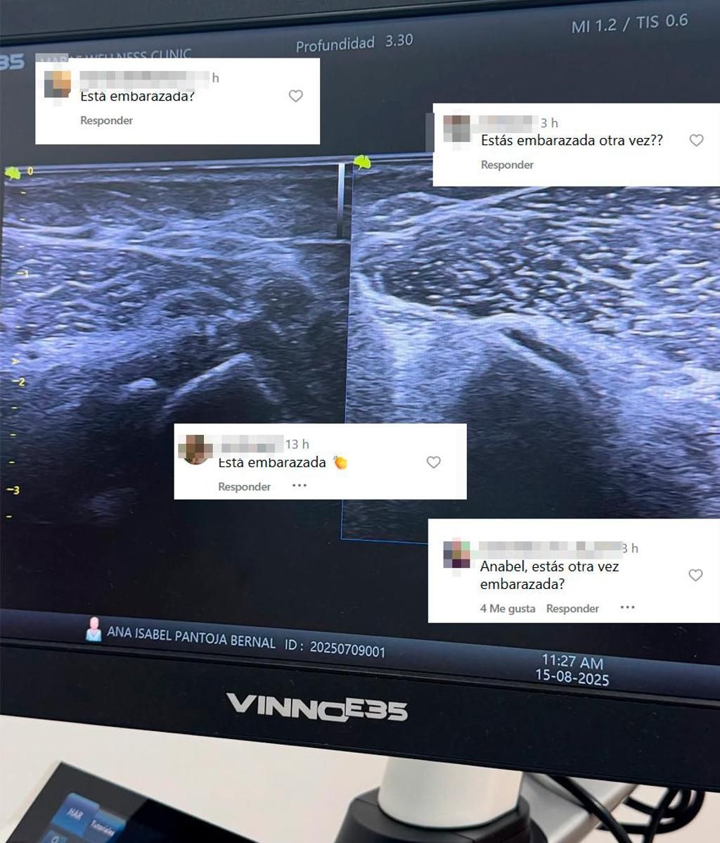 Anabel Pantoja comparte una ecografía y se disparan los rumores sobre un posible embarazo