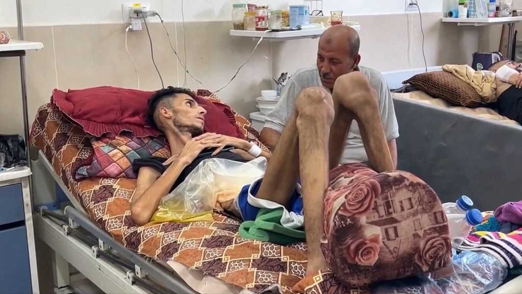 Morir bajo las bombas o de hambre en Gaza: la historia de un adolescente que agoniza en el hospital de Al Shifa