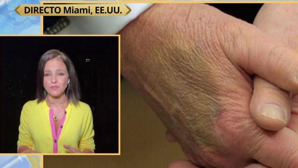 El verdadero motivo por el que Donald Trump se maquilla las manos antes de sus actos públicos