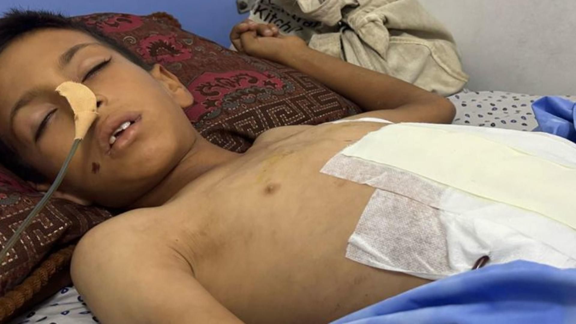 Un niño enfermo en un hospital de Gaza