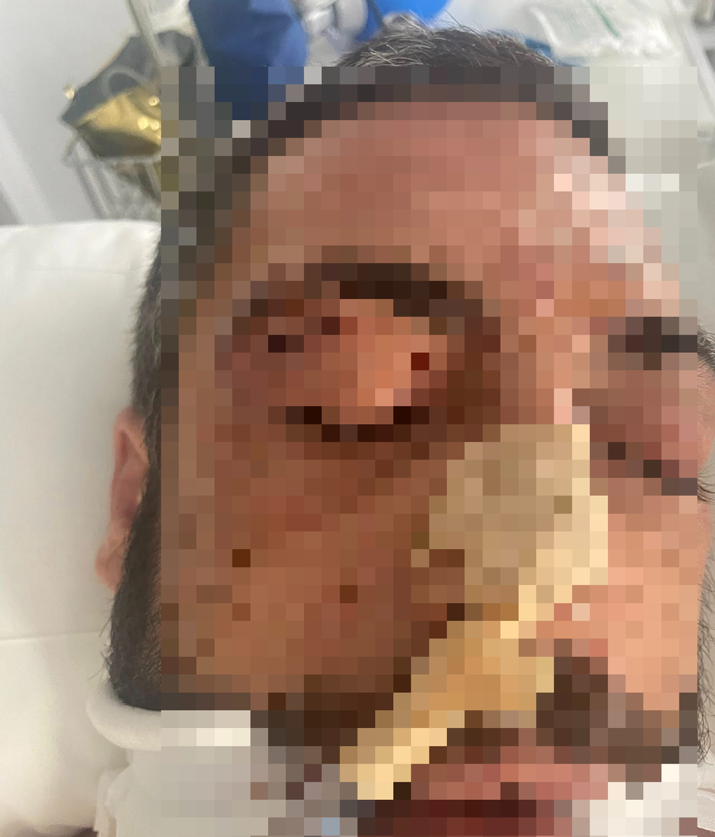 El hombre que arrancó un dedo a un guardia civil en Garrucha