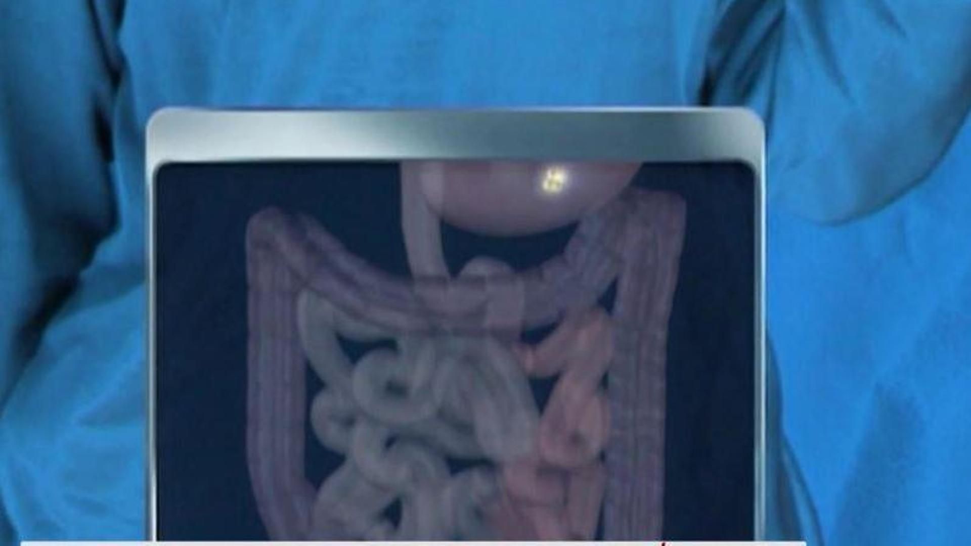 La relación entre la salud estomacal y el Alzheimer es más estrecha de lo que se creía: "El intestino es un segundo cerebro"