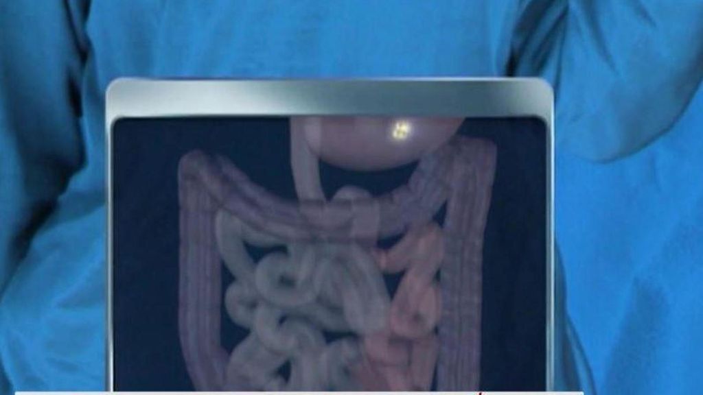 La relación entre la salud estomacal y el Alzheimer es más estrecha de lo que se creía: "El intestino es un segundo cerebro"