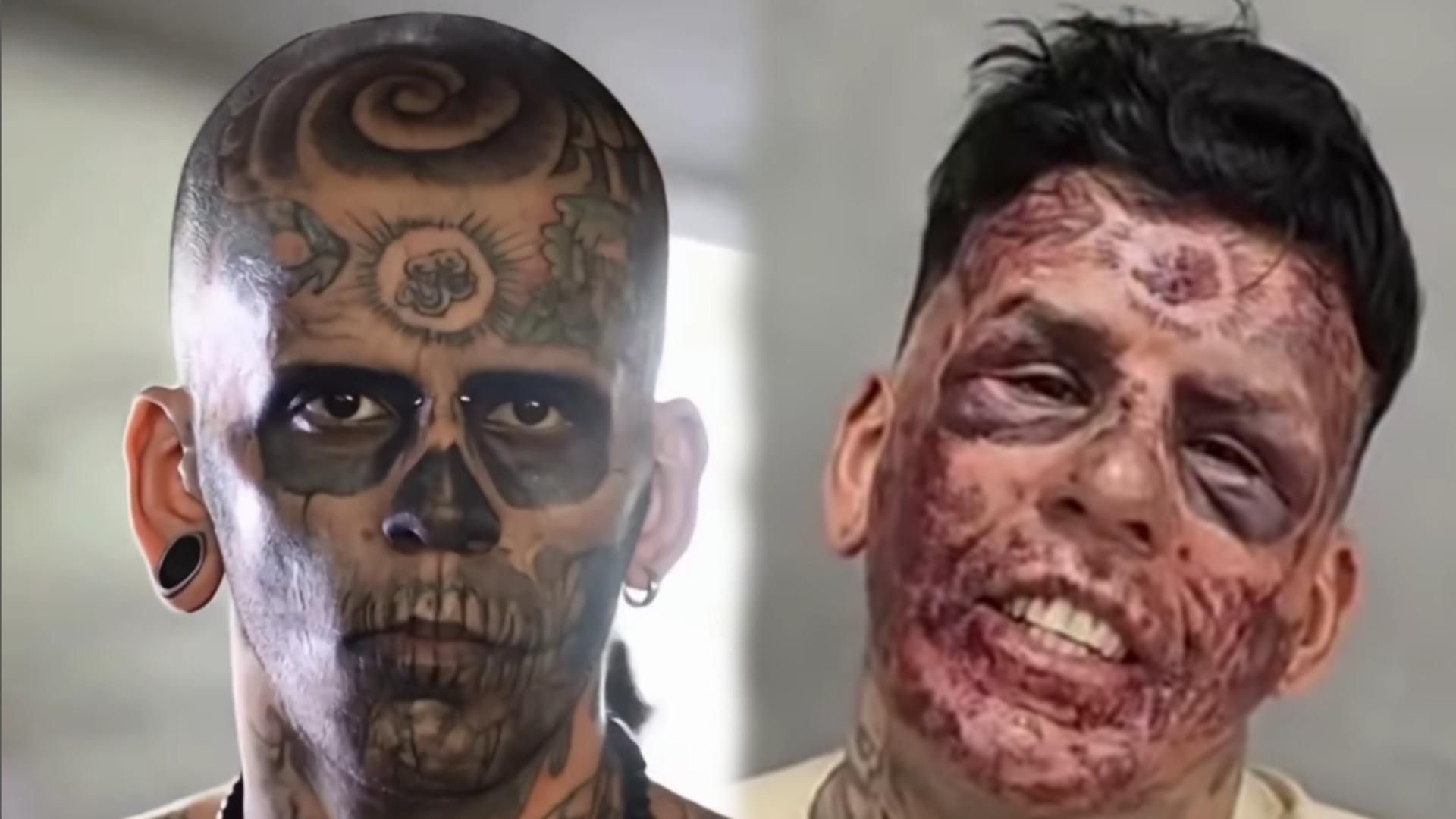 Leandro de Souza, el hombre más tatuado del mundo, decide quitarse toda la tinta de la cara: "Se trata de arrepentimiento"