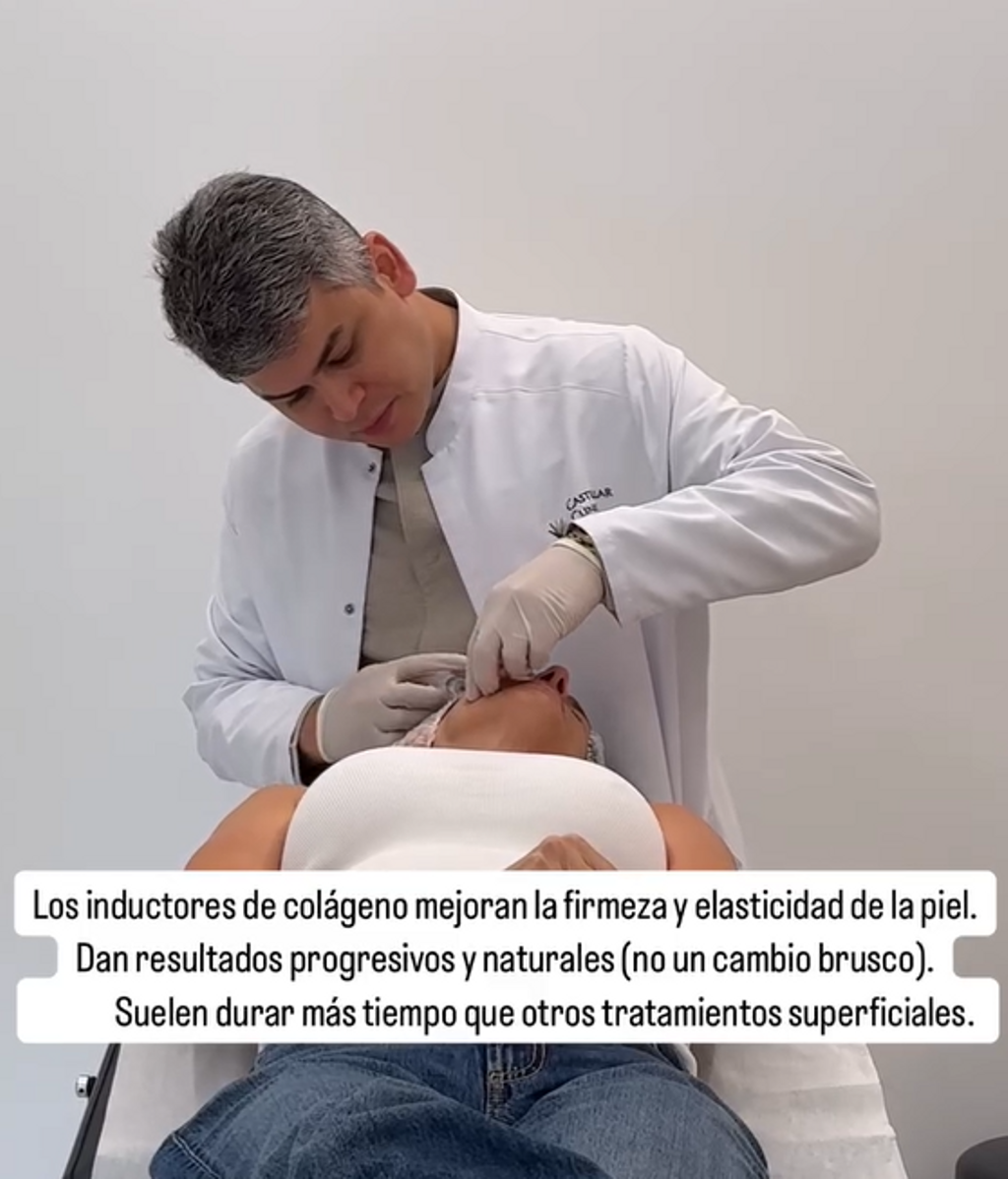 Retoque estético de Elena Rodríguez