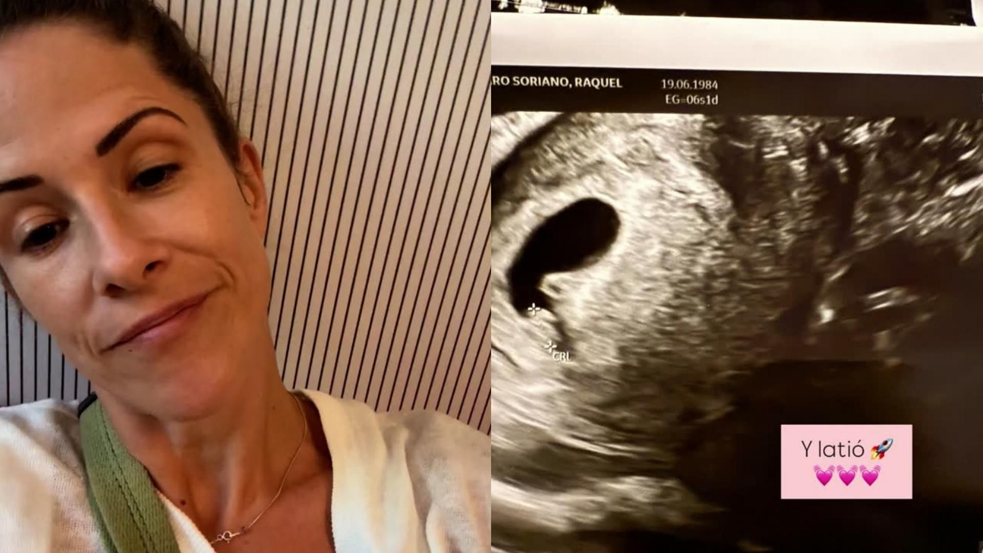 Rakel cernicharo, embarazada primer hijo