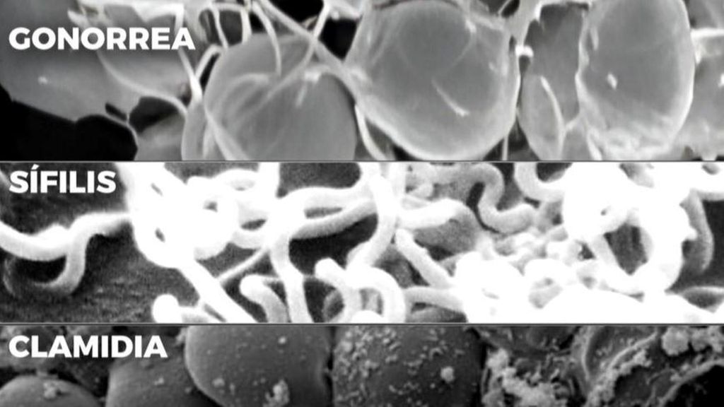 Llamamiento a la prevención en el día mundial de la salud sexual: las infecciones por gonorrea se ha duplicado en un año