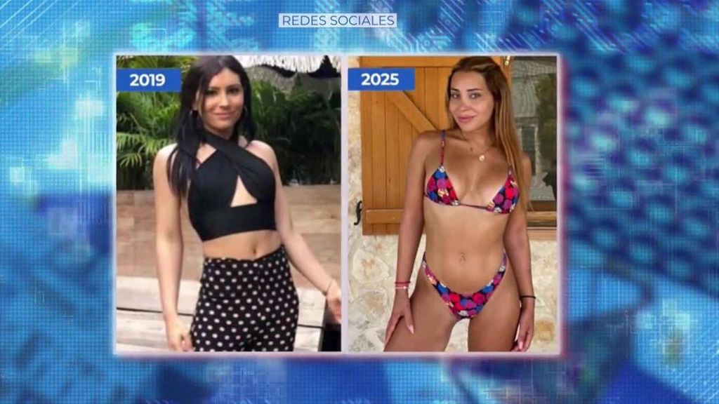 ¿Obsesionada con las operaciones?: el antes y el después de Daniela Requena tras 12 intervenciones quirúrgicas