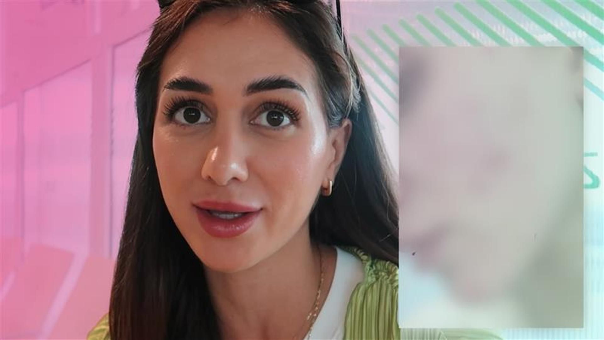 Maica Benedicto muestra cómo tenía la cara cuando le dio un fuerte brote de acné Obvio microbio Temporada 1 Top Vídeos 26