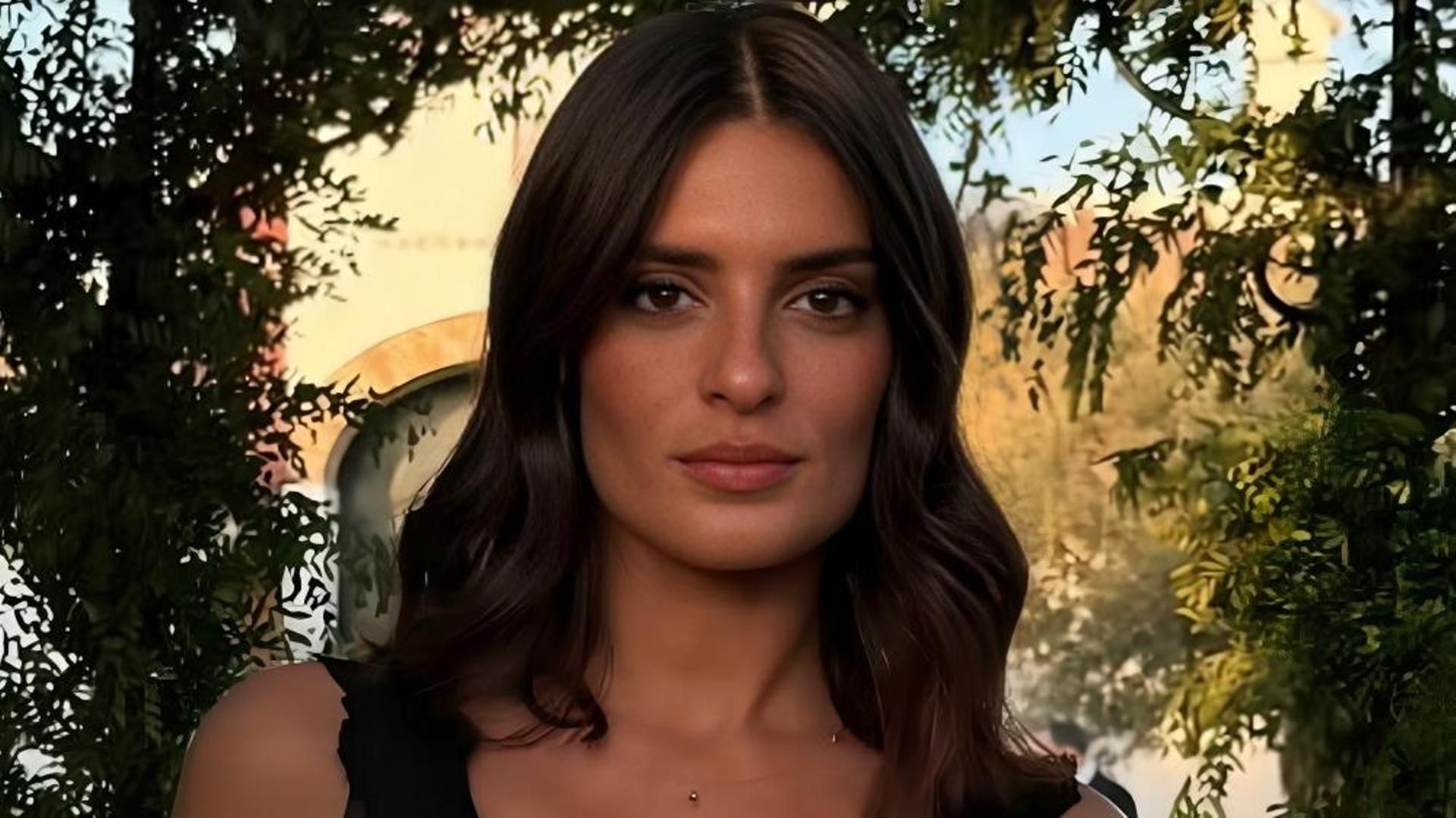 Susana Molina se somete al tratamiento estético HIFU