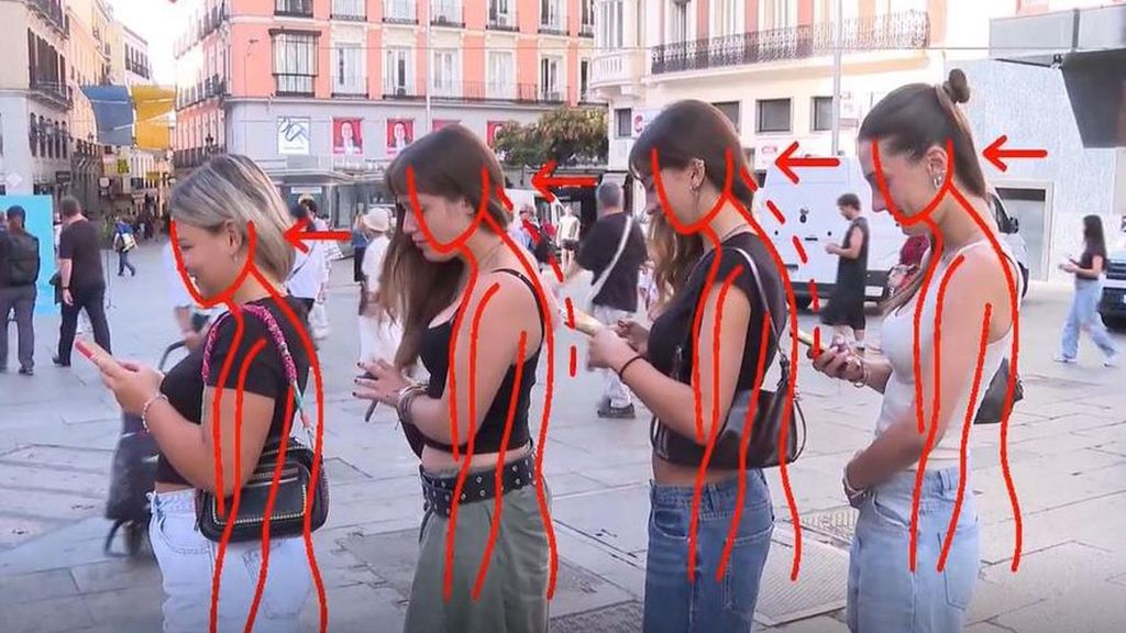 ¿Qué es el síndrome del 'cuello nerd'? El uso continuado del móvil empieza a cambiar nuestra fisionomía