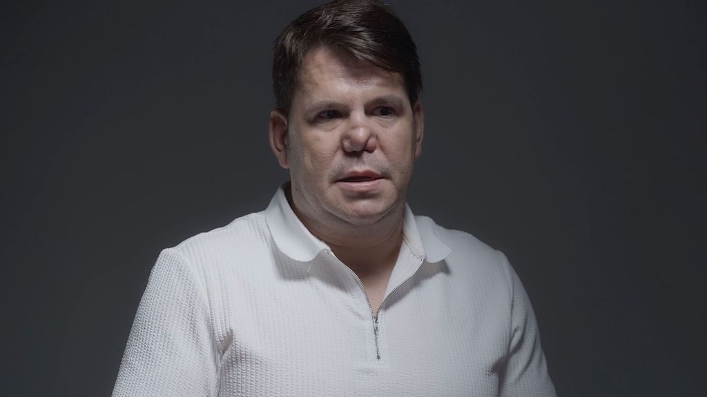 Lucas, de 'Andy y Lucas', rotundo sobre la situación de su nariz: "Estéticamente me he acostumbrado"