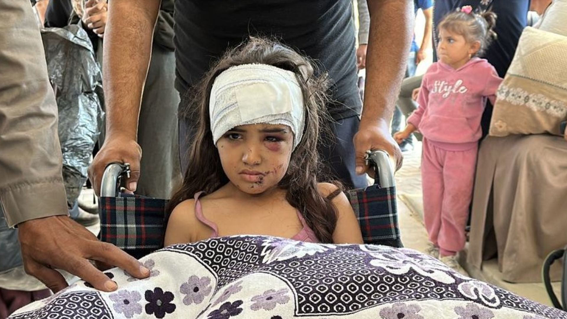 Una niña herida en un ataque militar de Israel en Gaza