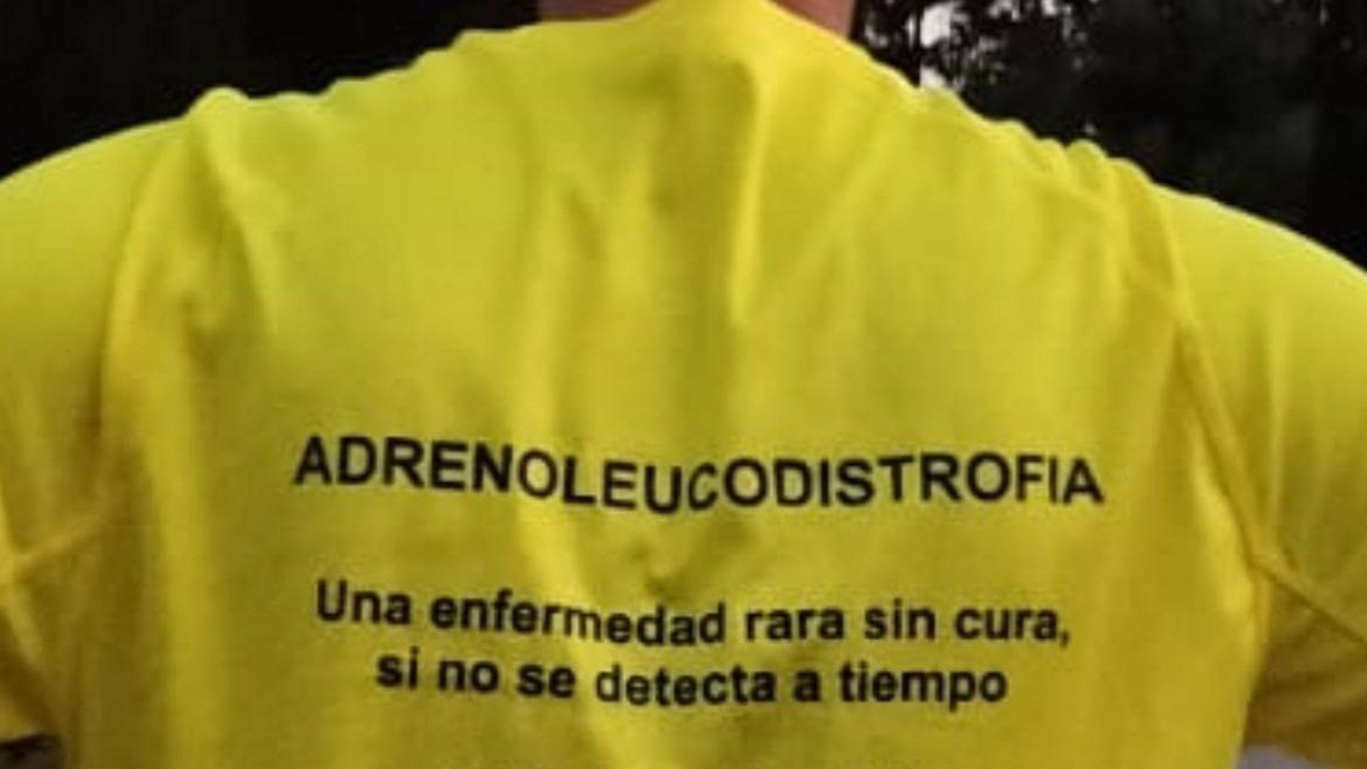 Camiseta para visibilizar la enfermedad rara cerebral de un menor durante la Carrera Nocturna del Guadalquivir