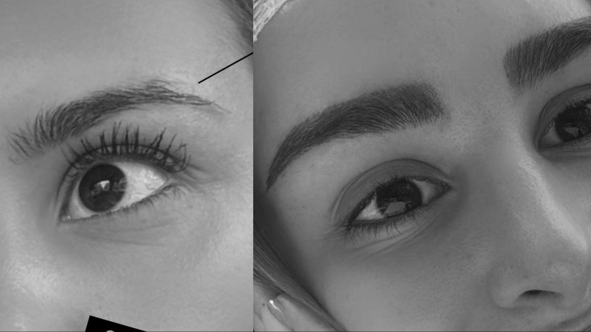 El antes y el después de Marina García tras su injerto de pelo en las cejas