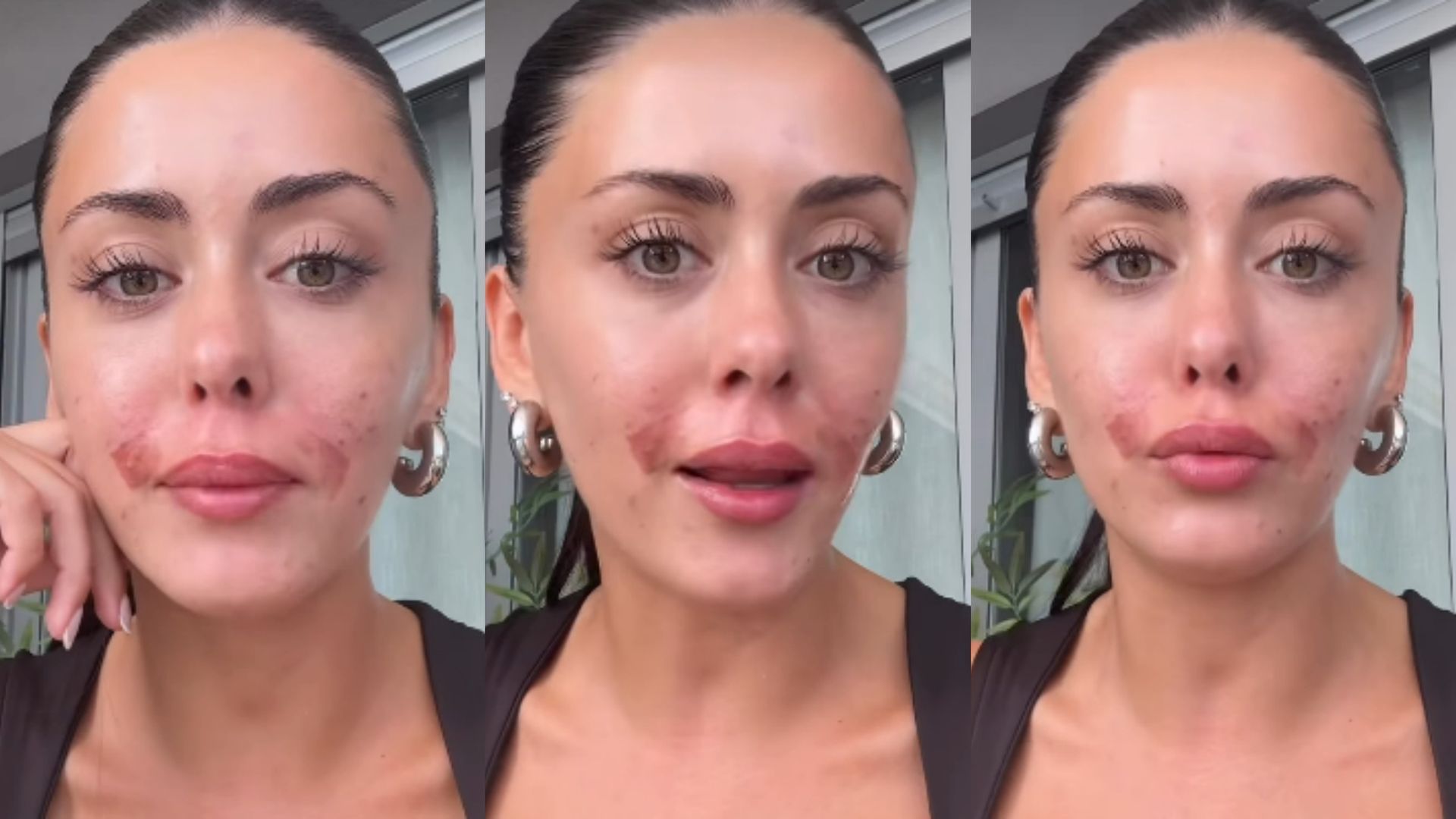 Rosario Matew muestra cómo se le ha quedado la piel