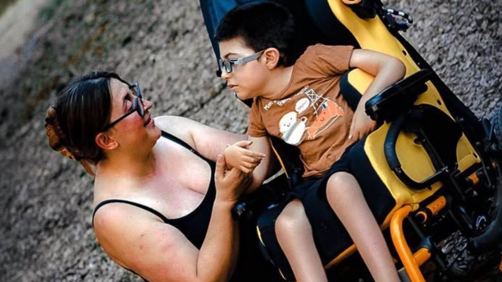 Oliver padecía la enfermedad de West