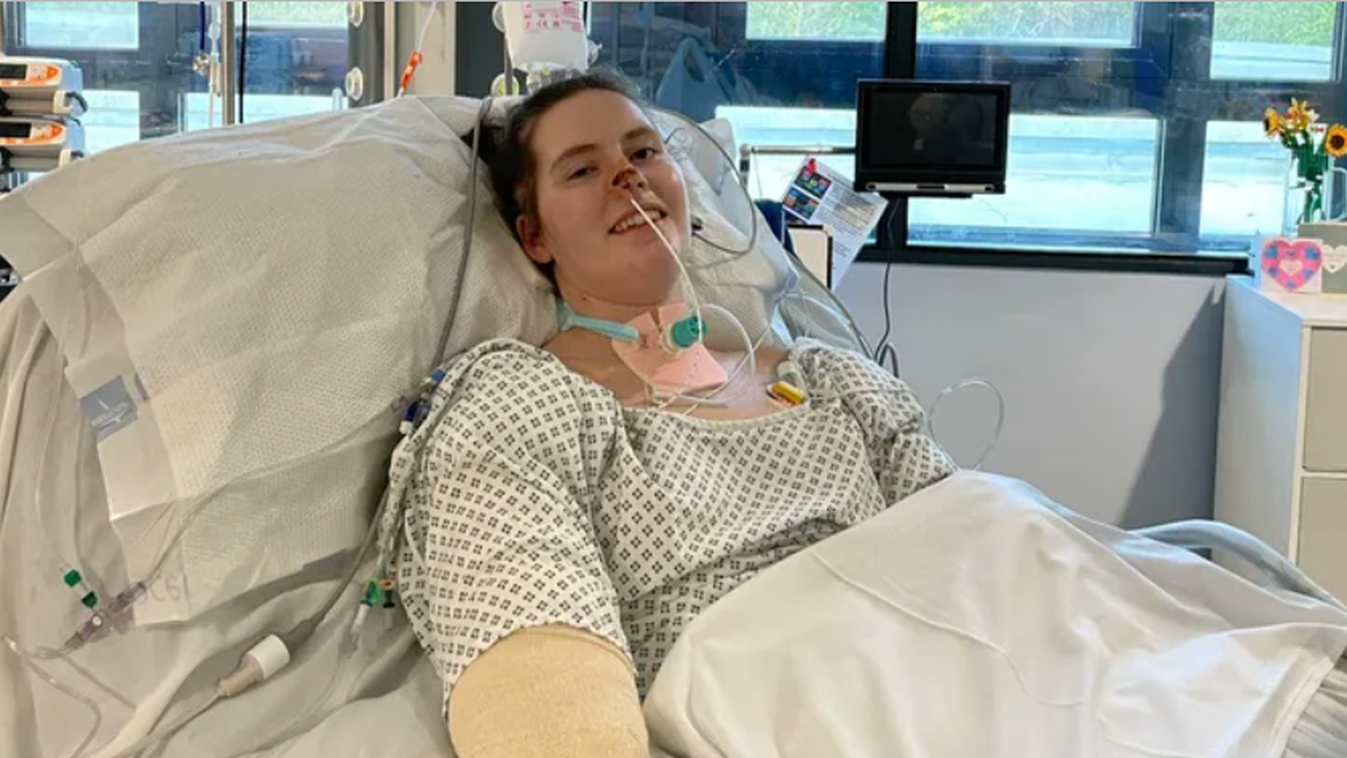 Lily McGarry, la estudiante que pensó que tenía gripe y acabó con las cuatro extremidades amputadas