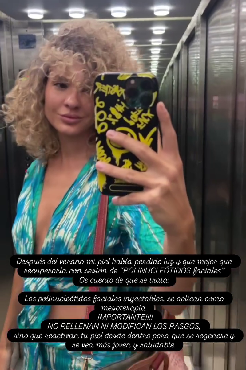 Sheila Casas ha mostrado el innovador tratamiento al que se ha sometido