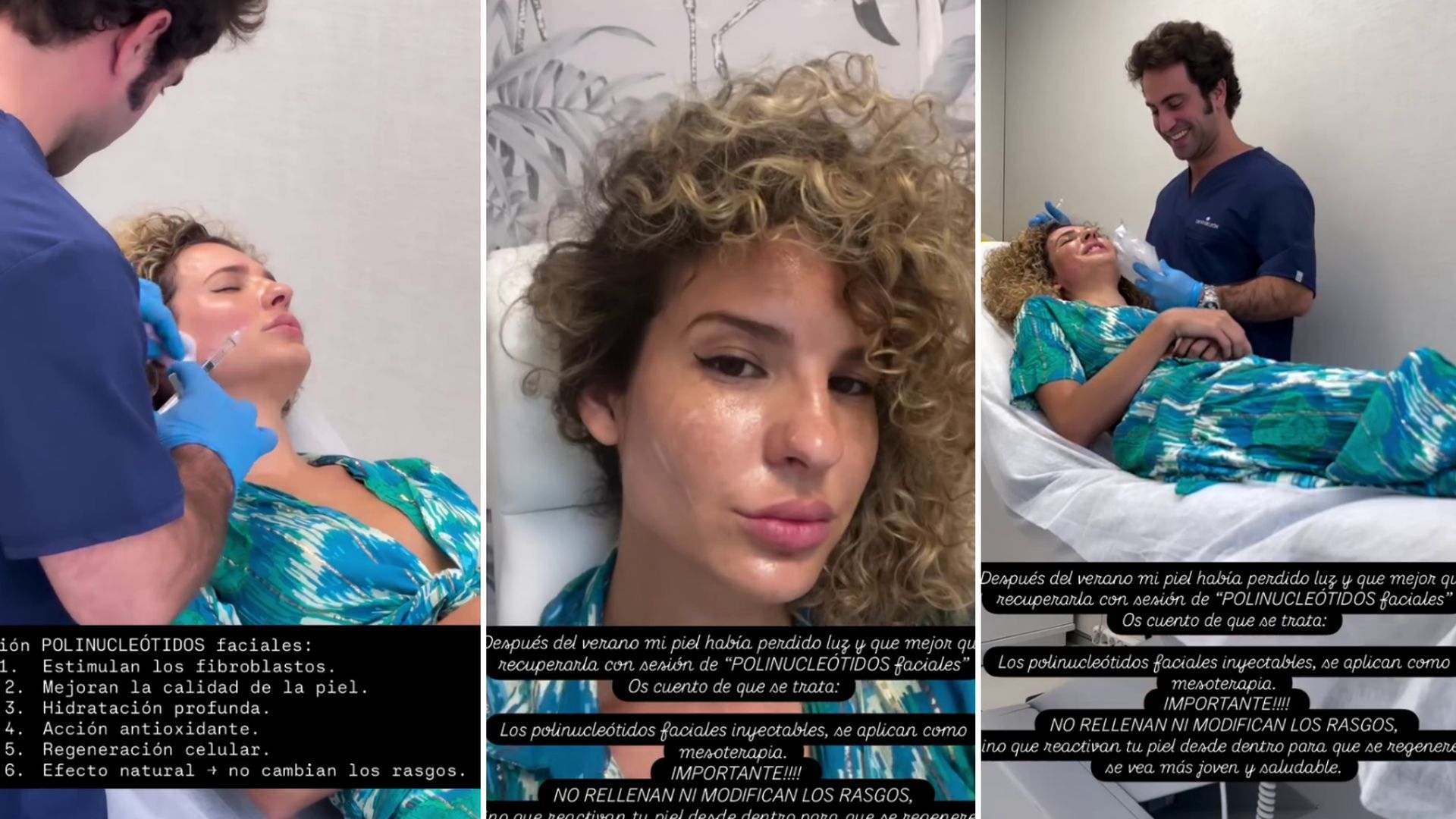 Sheila Casas se ha atrevido con los polinucleótidos, un tratamiento estético de rejuvenecimiento