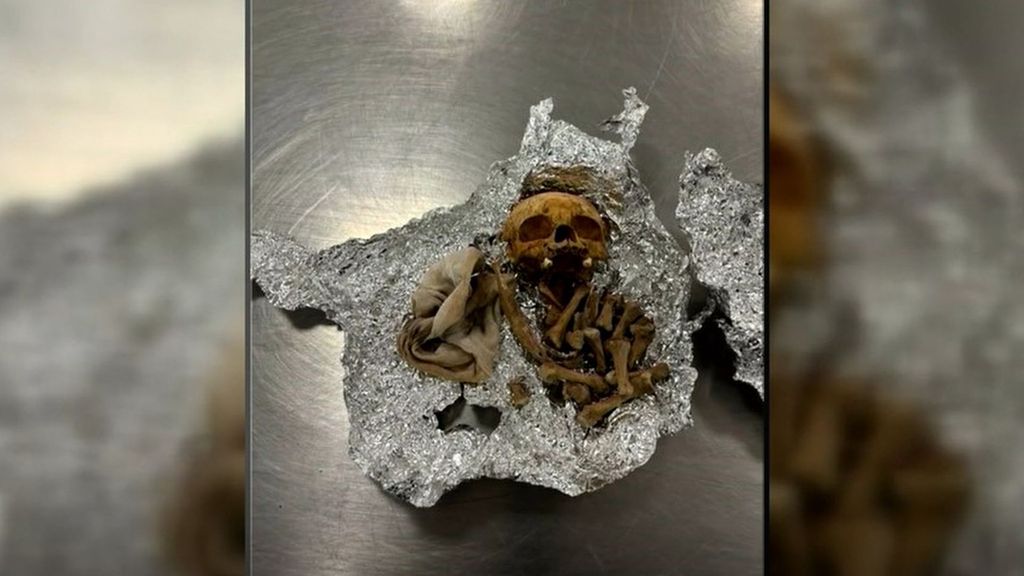 Un pasajero, retenido tras hallar restos humanos en el interior de su maleta en el aeropuerto de Florida