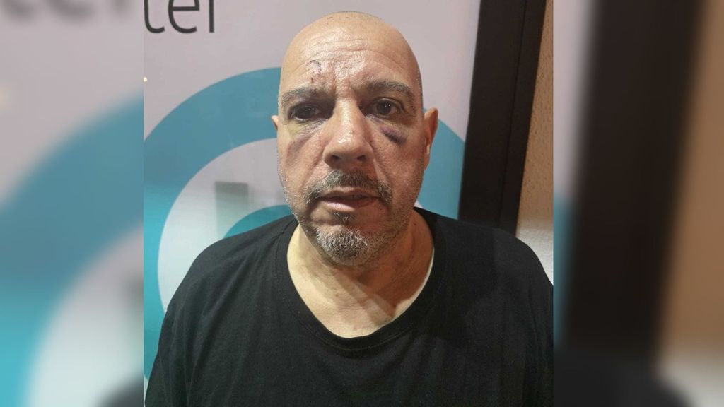 El testimonio de una víctima de un brutal robo con violencia en Marbella