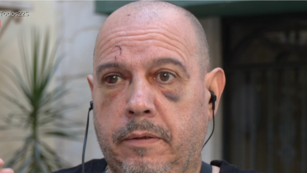 Un hombre, asaltado y brutalmente golpeado en Marbella: "Solo gritaba mientras me encañonaban con una pistola"