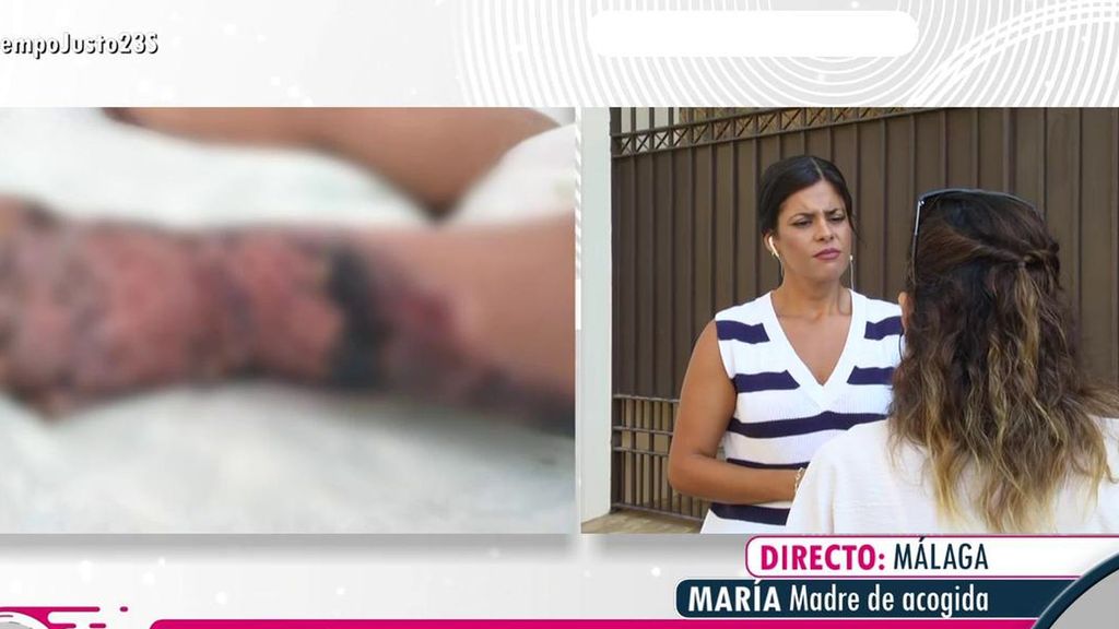 La madre de acogida denuncia el calvario del bebé maltratado al que metieron en agua hirviendo: “No solo tenía quemaduras”