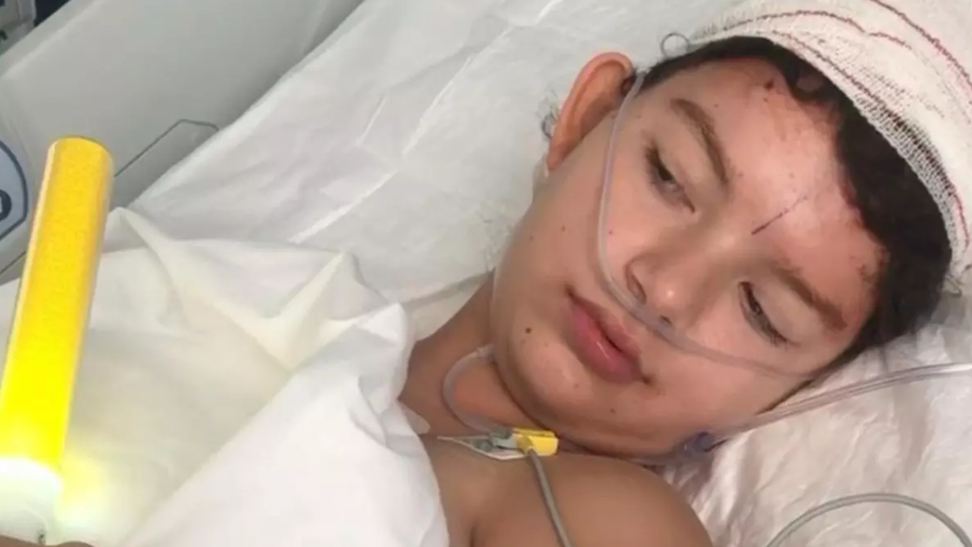 Claudia, la niña mallorquina con epilepsia severa