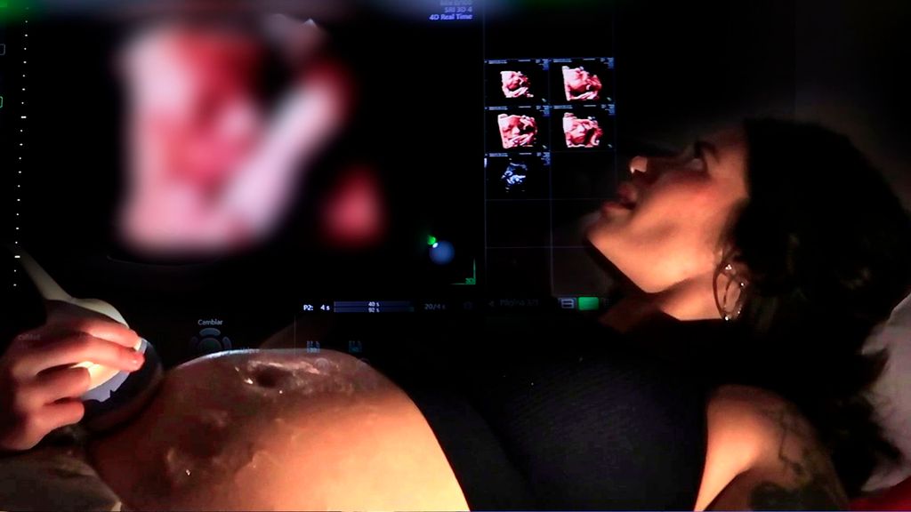 Fiama Rodríguez se somete a una ecografía 5D y enseña a su bebé Ya eras todo by Fiama Rodríguez Top Vídeos 10