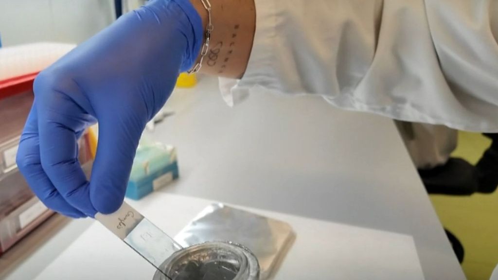 El prometedor tratamiento contra el cáncer que desarrolla el Hospital Sant Pau de Barcelona: “Vamos a atacar el tumor principal y evitar la expansión”