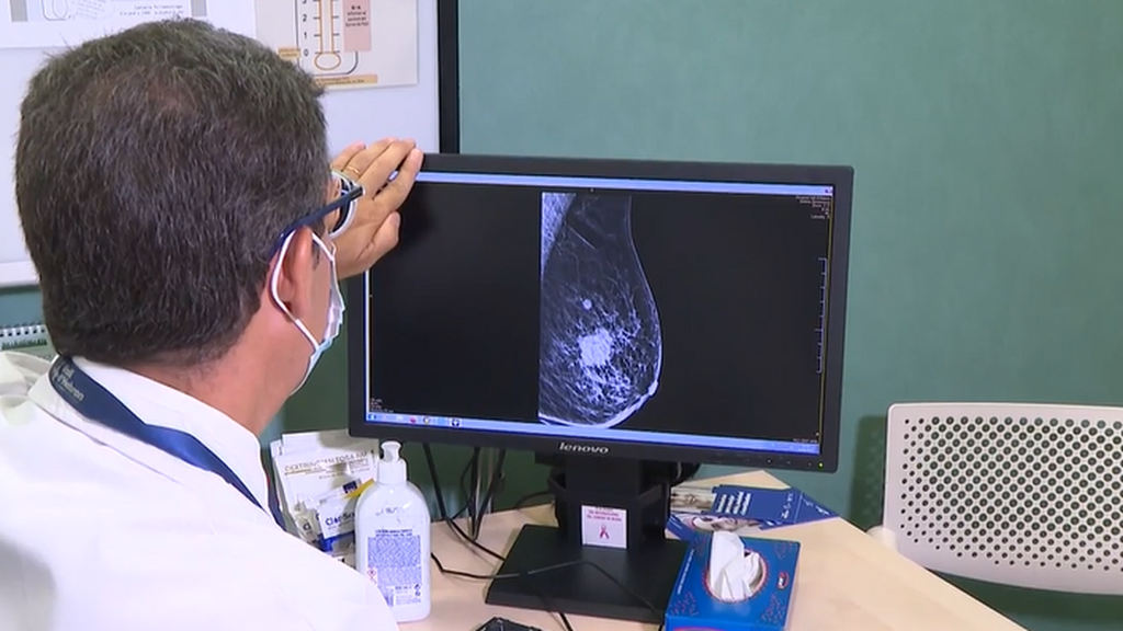 Prevén que el cáncer se va a disparar entre los milenials: la financiación no aumenta, los tiempos de espera sí