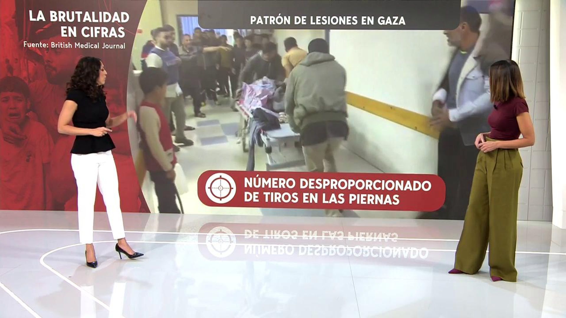 Las amputaciones se disparan en Gaza