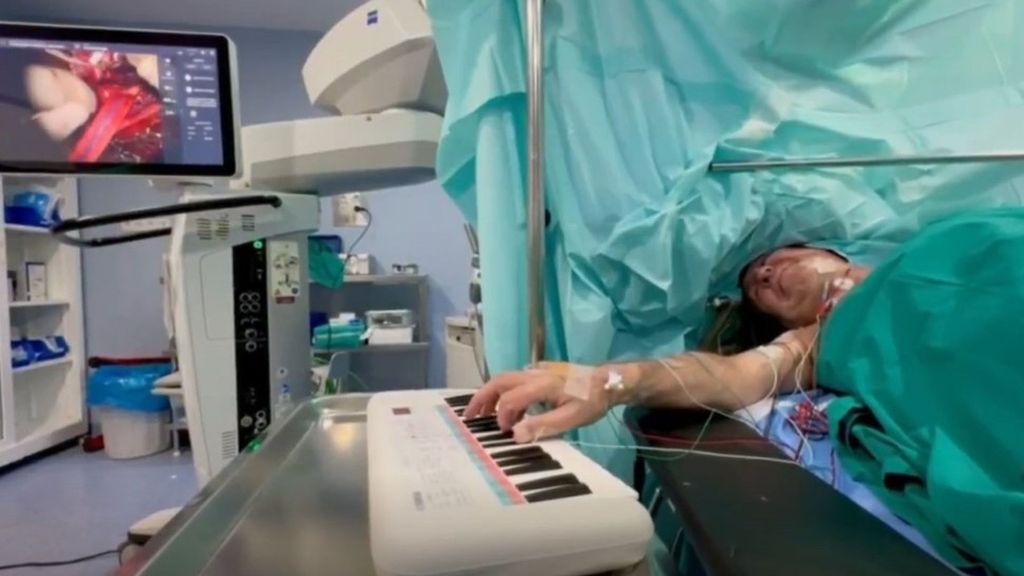 Un hospital de Córdoba opera de un tumor cerebral a un hombre mientras toca el piano