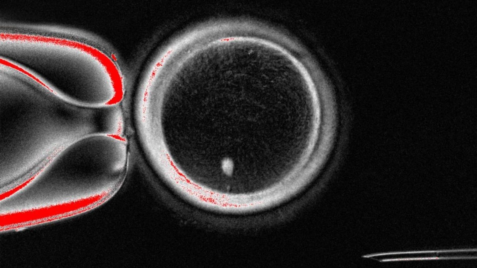 Un equipo de científicos fabrica óvulos humanos fecundables a partir de células de la piel