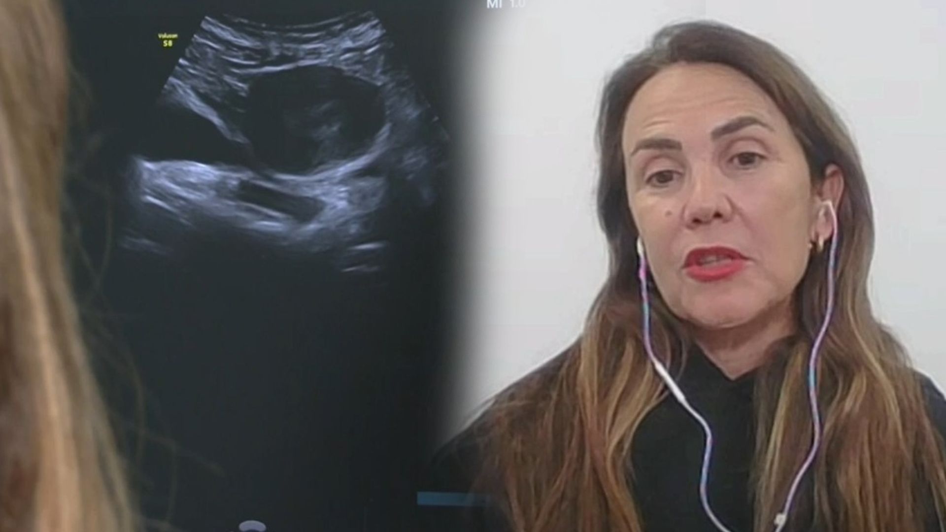 La psicóloga Diana Sánchez se pronuncia sobre el síndrome post aborto: "Necesitamos más evidencia científica para afirmar que existe"