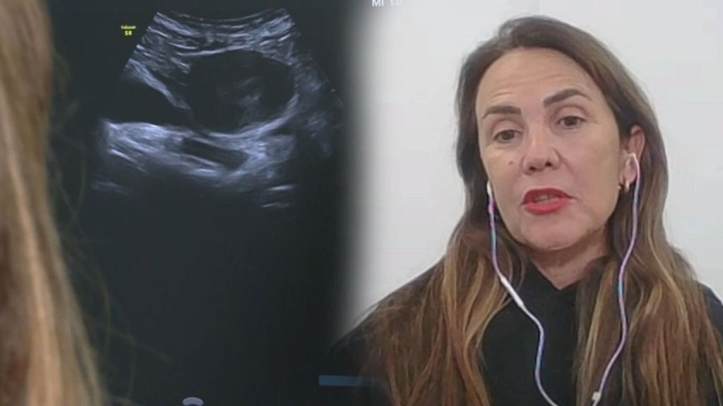 La psicóloga Diana Sánchez se pronuncia sobre el síndrome post aborto: "Necesitamos más evidencia científica para afirmar que existe"