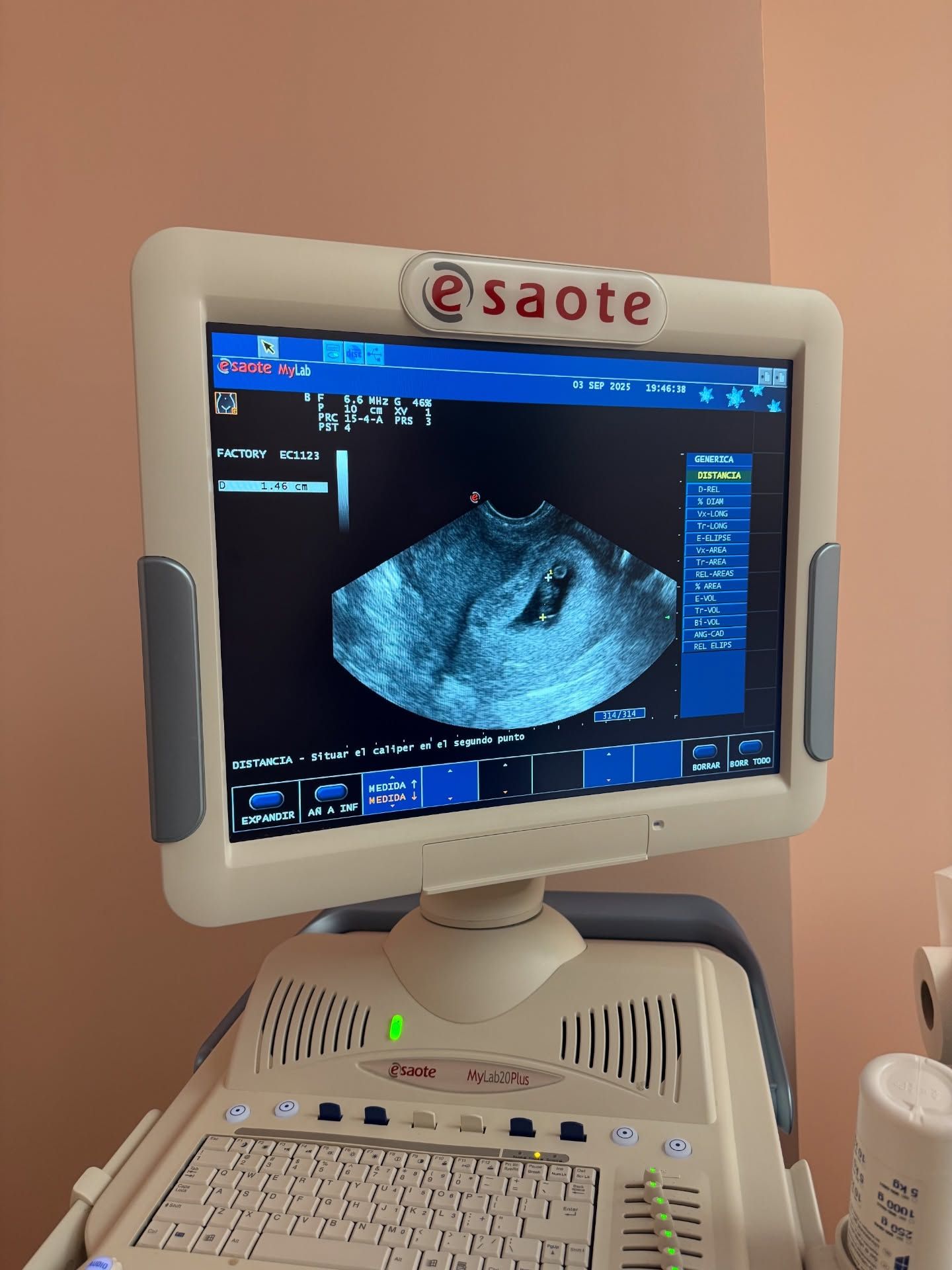 Rodri Fuertes comparte la primera eco del bebé que espera con Marta Castro