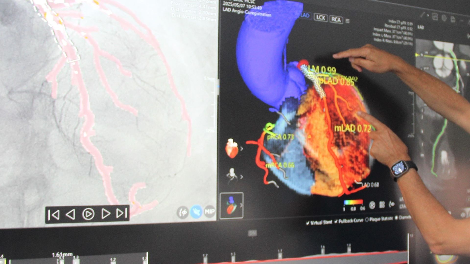 Un cardiólogo pediátrico sugiere vigilar la salud del corazón infantil antes de la práctica deportiva