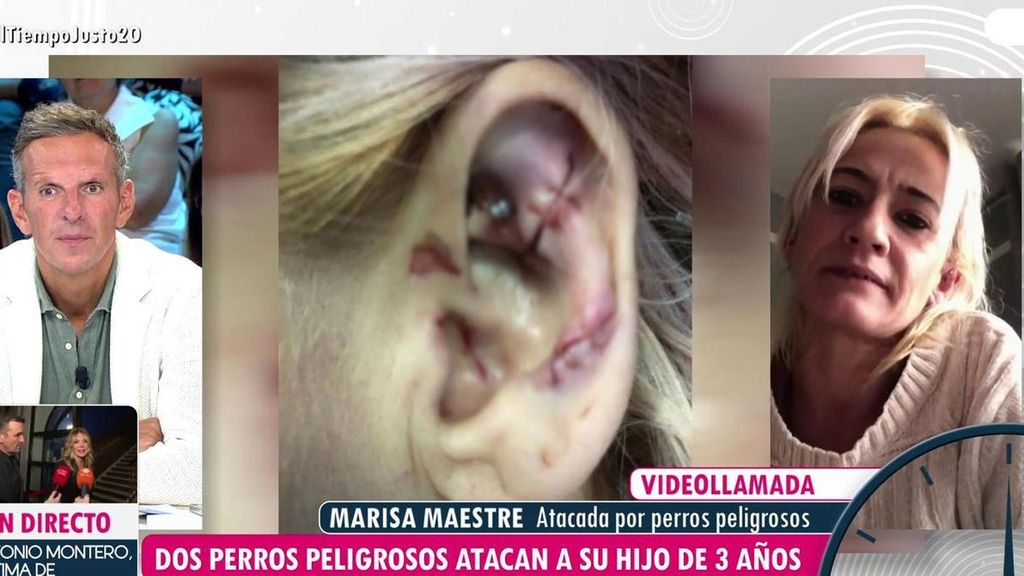 Los agónicos 13 minutos de la mujer que fue agredida por dos perros junto a su hijo: "Mi niño me decía: 'Llama a papá, nos va a matar'"