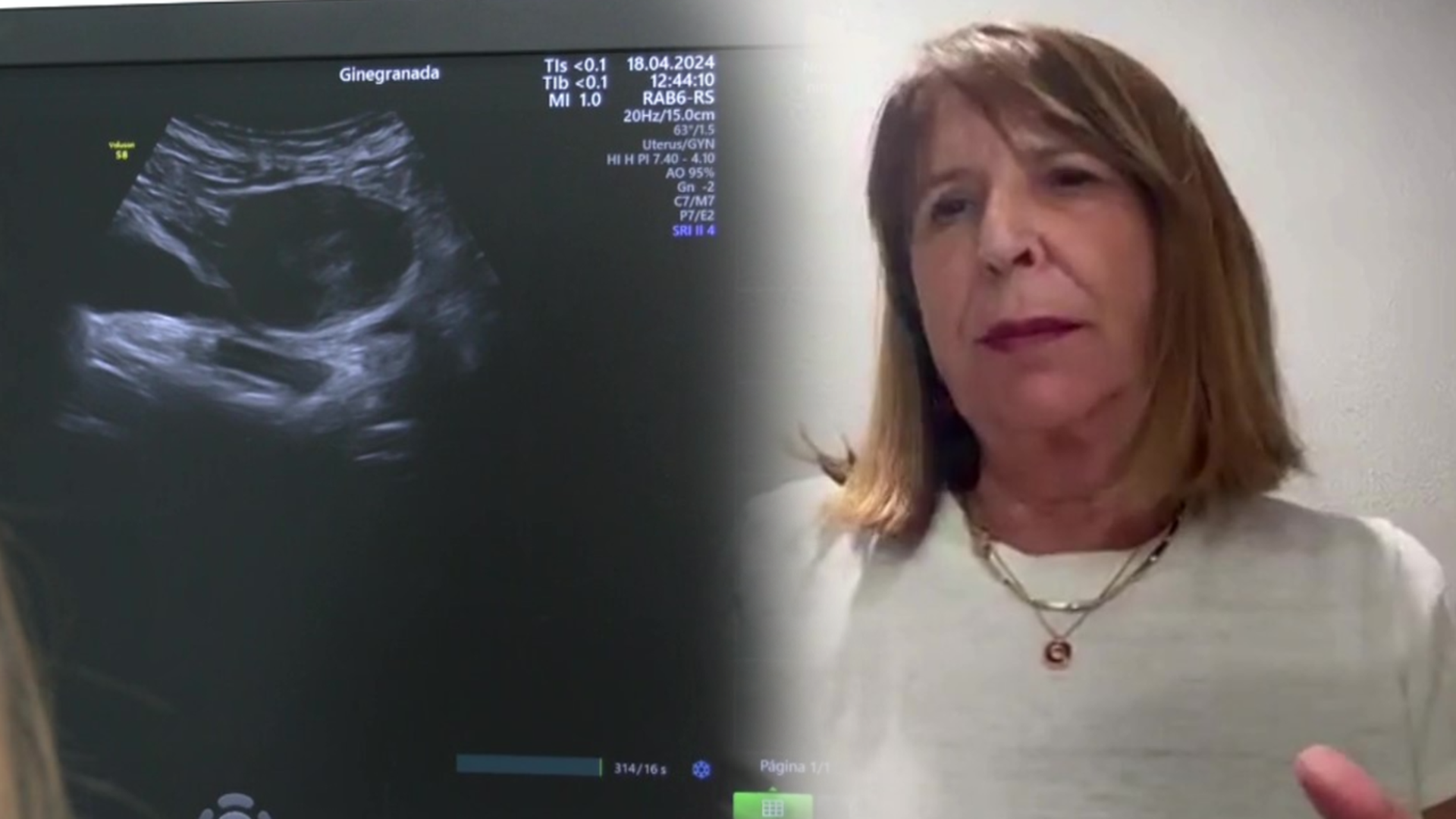 Francisca García, presidenta de la asociación de clínicas de aborto: "Se explican las posibles complicaciones, pero no un síndrome que no existe"