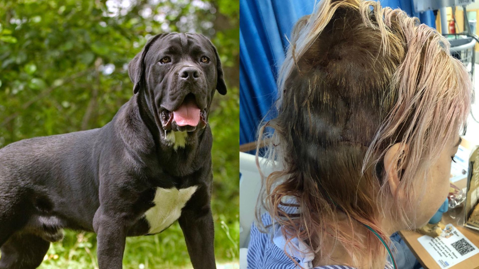 Marisa muestra la herida que dos perros le provocaron en su cabeza