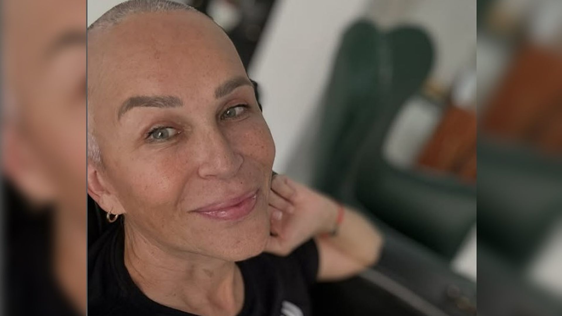 Antonia San Juan comparte su primera foto tras su tratamiento de quimioterapia: "Puedo mirar hacia adentro y no sentir vergüenza"