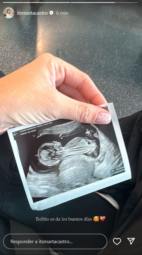 Marta Castro comparte la última ecografía de su bebé