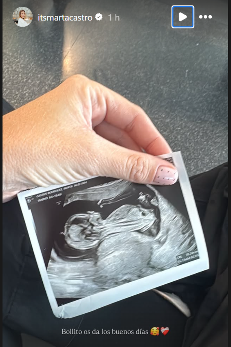 Marta Castro enseña la ecografía de su bebé