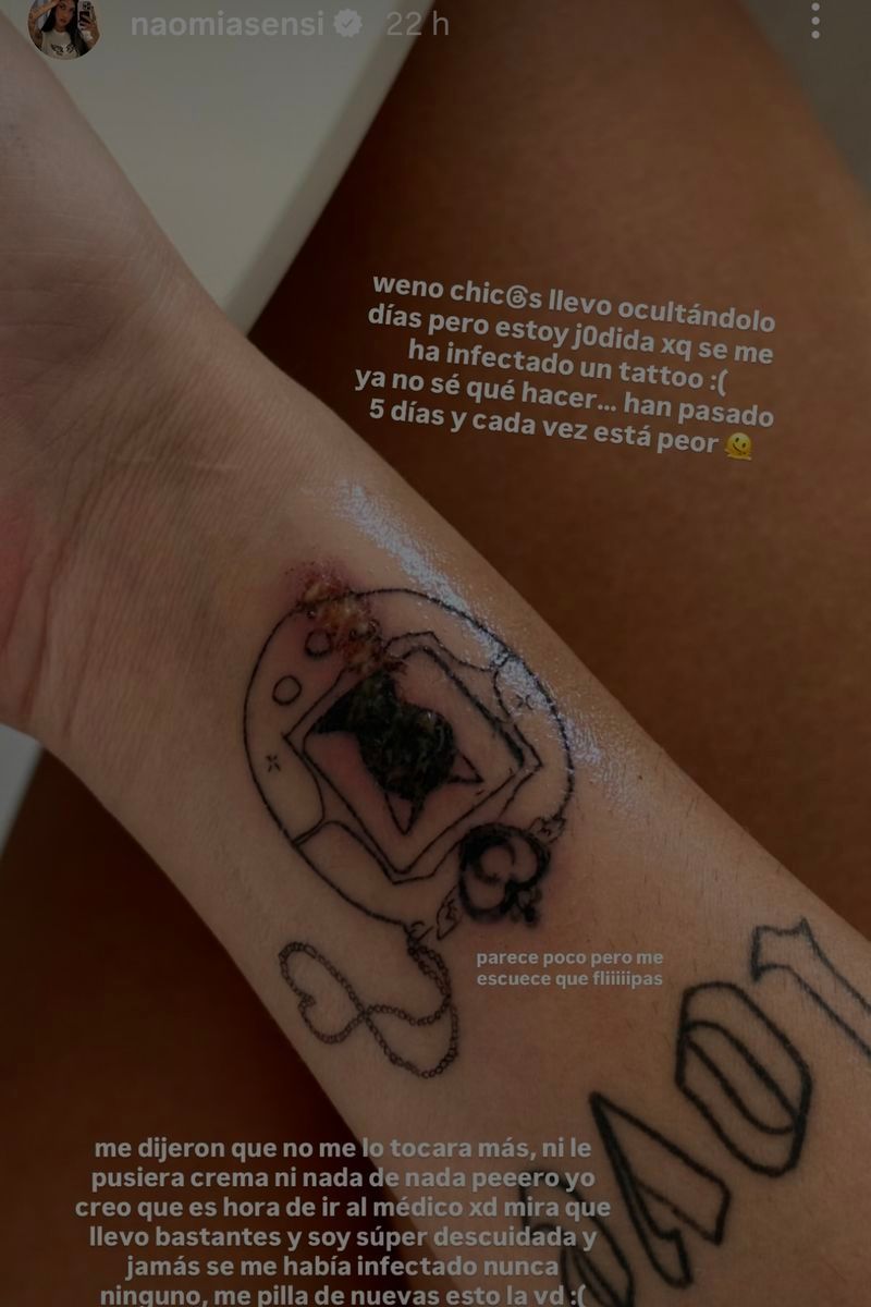 Naomi Asensi muestra la infección que se le ha hecho en un tatuaje